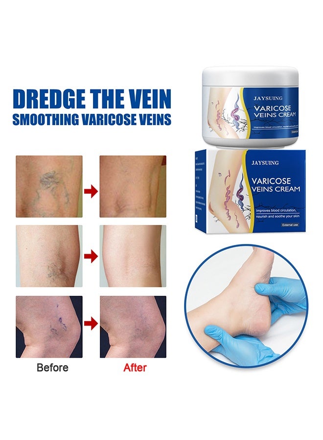 جايسوينغ كريم الدوالي - يحسن الدورة الدموية، يقلل من الأوردة العنكبوتية والثقل، 50 جرام - Image 2